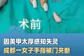 6月3日报道，成都一女子因美甲太厚，导致感知失灵，手指竟被门夹断！#大象主播说 @主持人夏冰