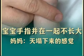 宝宝手指并在一起长不大，妈妈觉得天塌了 #波兰综合征 #畸形 #医学科普 #手术