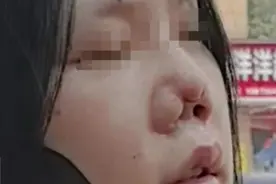 晨意帮忙丨美女称隆鼻后像“猪鼻子”索赔30万，整形机构指其吸毒，民警现场尿检视频封面