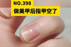 指甲空了是怎么回事？有可能是这些情况！#甲分离 #指甲空了一点 #美甲 #硬核健康科普行动