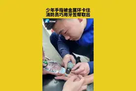 12月24日四川宜宾：少年手指被金属环卡住，消防员巧用牙签帮取出#蓝朋友 #消防员 #手指 