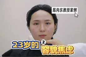 23岁姑娘容貌焦虑第二集 如何改善面部下巴短缩+法令纹#变美