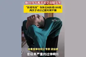 身体反向折叠180度！2月19日，四川成都，“折叠男孩”姜延琛二次手术成功，颈椎矫正40度后能平躺！期待他打开自己的“折叠人生”！#姜延琛 #折叠男孩
