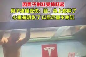 8月21日（采访时间），山东青岛。50多斤巨骨舌鱼因男子刷缸受惊跃起，男子被撞受伤：当时害怕极了，大脑一片空白。事情已过去3天，肿还没消，以后尽量不刷缸。