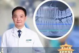 拔牙后做位点保存，有利于牙槽骨恢复。 拔牙后做位点保存，有利于牙槽骨恢复。#武汉种植牙 #武汉种植牙陈昊 #医学科普视频封面