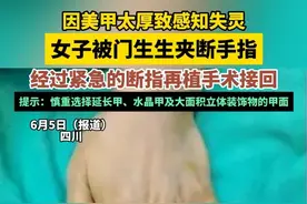因美甲太厚致感知失灵，女子被门生生夹断手指，经过紧急的断指再植手术接回，提示：慎重选择延长甲、水晶甲及大面积立体装饰物的甲面（畅）