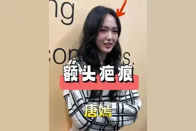 直到看清一张高清旧照，揭开唐嫣总留厚重刘海的真相，不仅仅是为了遮挡额头疤痕这么简单#唐嫣念无双 #杨幂 #罗晋 #娱乐评论大赏  #内容启发搜索