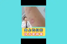 身上长红斑，以为是梅毒 身上长红斑，以为是梅毒#玫瑰糠疹 #梅毒 #医学科普 #硬核健康科普行动 视频封面