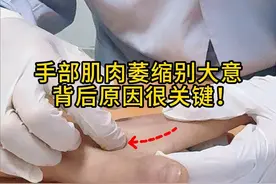 手部肌肉萎缩别大意  背后原因很关键！ #肌肉萎缩 #抖出健康知识宝藏  #开工去班味健康指南  #春季警惕这些高发疾病视频封面