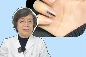 指甲上出现黑线，是癌症的前兆或身体不好？#医学科普 #指甲  #健康 #涨知识 #甲母痣