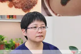 黑色素痣一定会恶变吗？恶变的几率高吗？ 谁提问的问题，来认领#胎记 #黑痣 #色素痣 #医学科普 #皮肤视频封面
