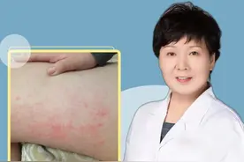 大腿内侧出现红疙瘩 瘙痒难忍 是怎么回事？ ##医学科普 #医疗小常识 #