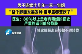 6月5日（发布），河南郑州，男子连续十几年一天一包烟，“整个脚面发黑发肿 指甲盖都变灰了”，医生：80%以上患者有吸烟的病史，严重的话可能会截肢#河南dou知道 #抽烟有害健康 #吸烟有害健康