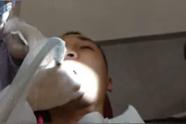 美食博主体验#皓齿美白 #牙齿。真的变白了吗？大家觉的怎么样？
据说这是#冷光美白 的微升级版#杨肉串 #牙齿美白 #牙齿健康 