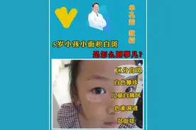 5岁小孩身上醋出现小面积白斑是怎么回事？ #白癜风 #孩子白斑 #广州 #白癜风 #单孔荣医生