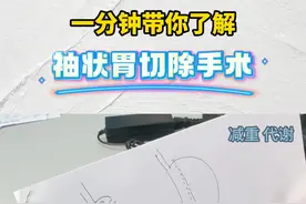 袖状胃切除是什么原理，也就是大家常问到的减重代谢手术，今天给大家画出来了，希望对您有帮助。#减重代谢手术 #减重 #袖状胃视频封面