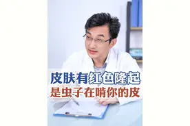 无论是在外面还是在家里，警惕有这种红斑的人，握个手就会被传染 #疥疮 #学生宿舍 #传染病 #硬核健康科普行动  #医生科普视频封面