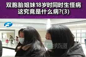 河南许昌：双胞胎姐妹，18岁时同时生怪病，到底咋回事？（3）#双胞胎 #怪病 #河南dou知道 视频封面