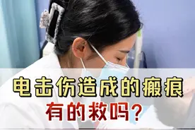 电击伤造成的瘢痕有的救吗？ #瘢痕 #疤痕 #硬核健康科普行动  #头条双星激励计划 #瘢痕修复