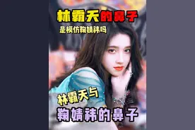 网红林霸天的鼻子是在模仿鞠婧祎吗 我是成都做鼻子的段焘医生，希望想做鼻子的求美者刷到我，特别是成都或者成都周边的#成都隆鼻 #林霸天 #林霸天鞠婧祎 #段焘 #变美视频封面