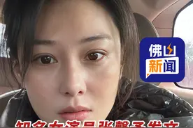 知名女演员张馨予发文，称自己突然得了斑秃，“可能最近精神和身体压力比较大”！（来源：@张馨予 、极目新闻；编辑：曾凝霜）#明星 #张馨予 #脱发 #健康科普