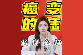 可能会癌变的痣长什么样？身上出现这几种痣要注意！ #痣  #色素痣  #癌变痣  #医学科普 #抖出健康知识宝藏