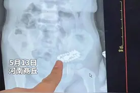 妈妈的金手串不见了 两岁宝宝说被自己吃到肚子里，带去医院检查发现……视频封面