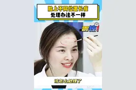 终于有医生说清楚，脸上不同位置长痘该怎么处理了！#痘痘 #长痘 #祛痘 #护肤 #硬核健康科普行动视频封面