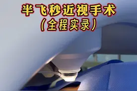 半飞秒近视手术（全程实录） 半飞秒近视手术（全程实录）#半飞秒近视手术 #近视手术