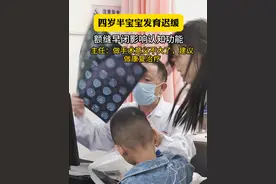 额缝早闭影响认知功能，建议尽早手术治疗！ #我的门诊故事 ﻿﻿#舟状头 ﻿﻿#颅缝早闭 #医学科普视频封面