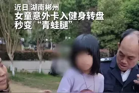 女孩意外滑入健身器材秒变“青蛙腿”，消防员暖心救援。视频封面