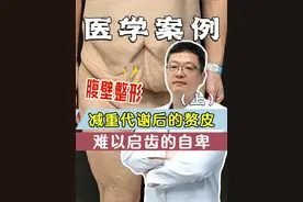 减重代谢后的赘皮(上)，难以启齿的自卑 #腹壁整形 #腹壁成型 #八大处金骥 #减重后赘皮 #案例讲解
