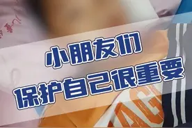 小朋友们，保护好自己很重要！11岁小朋友跳三轮车摔伤导致#颅内出血  #儿童脑科小米大夫 #西安市儿童医院神经外科 #硬核健康科普行动