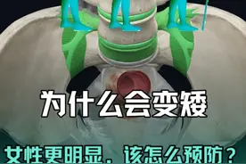 中年后为什么会变矮，女性更明显，怎么预防？ #解剖学 #医学生视频封面