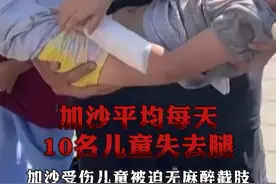 #加沙平均每天10名儿童失去腿  #加沙受伤儿童被迫无麻醉截肢视频封面