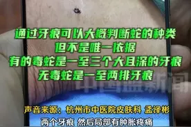 男子被蛇咬伤右脚，抓蛇过程中又被咬伤左脚， 最后蛇却逃走了，医生在线教你分辨咬你的蛇有没有毒。#毒蛇
