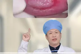 别错把梅毒硬下疳当作口腔溃疡！一旦发现建议即刻治疗！#梅毒 #口腔溃疡 #皮肤 #硬核健康科普行动  #性病