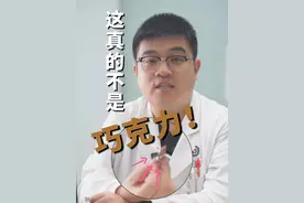 认清楚，这真不是巧克力！ #痔疮栓 #马应龙