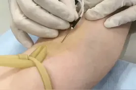 中国疾控中心放大招！艾滋、甲乙丙肝、梅毒，一张身份证可全国追查！#疾控中心 #筛查