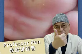 鸡眼能不能冷冻治疗 #鸡眼 #冷冻治疗 #鸡眼去除小妙招