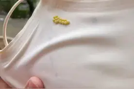 头皮发麻！女子晾的衣服被臭屁虫产卵，不要用手直接触碰 否则会灼伤皮肤#臭屁虫  #衣服 #虫卵视频封面