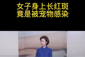 【女子身上长红斑 竟是被宠物感染】
最近，杭州市第一人民医院接诊了不少年轻人，他们都有着相似的症状，就是手臂上长出了成片的、铜钱状的暗红色斑点，并伴有瘙痒，这究竟是种什么病呢？视频封面