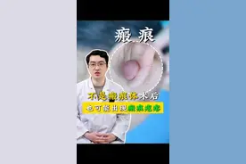 不是瘢痕体，术后也可能出现瘢痕疙瘩 #瘢痕 #耳垂瘢痕疙瘩 #北医三院张辰博士