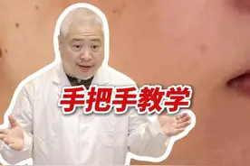 长了#黄褐斑 ，表皮斑一颗，皮下斑一窝，医生分享一个小妙招！#抖出健康知识宝藏  #护肤 #祛斑 #淡斑