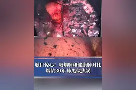 触目惊心！吸烟肺和健康肺对比天差地别，珍爱生命，远离烟草（素材来源@胸外科范军强医生 剪辑：实习生 马文心）