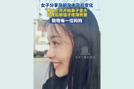 5月25日（发布）云南昆明。女子分享孕前孕中孕后变化，“第五个月开始鼻子变大” 分娩后颜值才逐渐恢复，致敬每一位妈妈。#怀孕后的变化 #孕激素影响 #致敬妈妈 #辛苦了妈妈