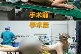 5月25日，北京，下午15点02分，“折叠男孩”首次手术成功！颈椎部位从反向折叠恢复近90度。后续他将佩戴头盆环继续矫正，为下次手术做准备！#折叠男孩的心愿视频封面