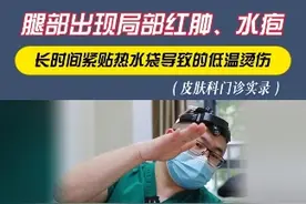 腿部出现的局部红肿、水疱，要注意 #硬核健康科普行动  #科普一下 #知识科普 #低温烫伤 #冬季