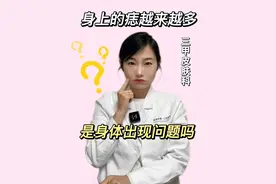 痣变多了，是身体哪里有问题吗？#痣 #痣的魅力发散时间 #医学科普 #希望能帮到你 #健康守护计划视频封面