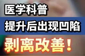 线雕提紧面部后，因韧带粘连导致凹陷显现，可以通过皮下剥离改善 #医学科普 #面部年轻化 #脂肪填充视频封面